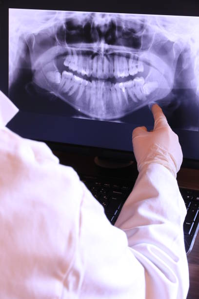 Best Emergency Treatment for Dental Infections or Abscesses in Berkeley, CA