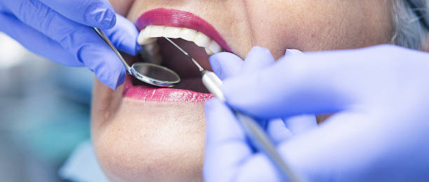 Best Emergency Wisdom Teeth Removal in Berkeley, CA